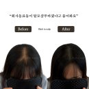 블랙인스칼프 이미지
