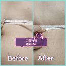 한라비발디2단지 | 지움 뷰티 복부관리 후기 #군산복부관리 #군산림프관리 #군산마사지