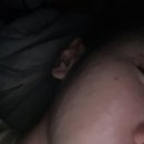 나세르의원 | [나세르의원] 내돈내산 수면리쥬란힐러 스킨부스터 리쥬란후기 2회차 엠보