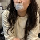 어린공주성형외과의원 | 어린공주 입술필러 후기