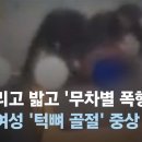﻿뺨 때리고 발로 밟고 '무차별 폭행'…피해 여성 '턱뼈 골절' 중상 / JTBC 뉴스룸 이미지