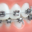 이지원치과교정과치과의원 이미지