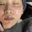 부산 화명동 피부과 쥬베룩스킨 모공레이저 일주일차 후기 (통증,아픔 정도)