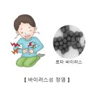 바이러스성 장염 이미지