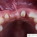 더힐 치과기공소 이미지