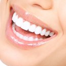 예담치과 이미지