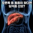 오른쪽 등 통증, 담석증 신호일까? 증상·원인·예방법 총정리 이미지