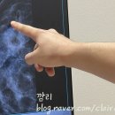 부평 성모하와유외과의원_30대 유방암 진단 확정 / 대학병원 연계