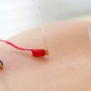 경희차이한의원 이미지