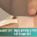 헤파린캡 연결하기 이미지