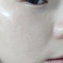 유스케어 | 서면 피부과 유스힐 스킨케어 솔직 후기!