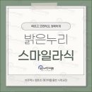 스마일PC | 대전스마일라식후기 차이 및 비교