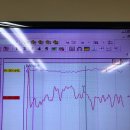 한림보청기 이미지