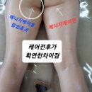 미즈스킨케어 이미지
