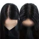 라이모플러스(LYMOPLUS) | 마곡탈모 마곡·발산 라이모플러스 방문 후기