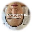 강릉 피부관리와 다이어트 제이뉴스킨 1회 후기