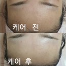 에스테라피 이미지