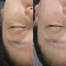 송송테라피 이미지