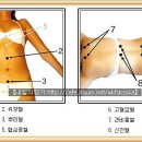 사혈요법 - 고혈압과 저혈압 이미지