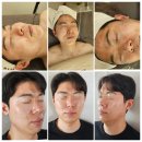 미유에스테틱 | 서면여드름관리 미유에스테틱, 17년 경력 원장님 케어 후기