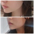 강남 피부관리 강남 에스테틱 친절하고 효과 좋은 태와선 재방문 후기