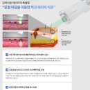 셀렉트피부과의원 네이버블로그