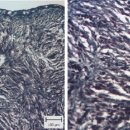 금붕어의 섬유아세포 유래 섬유육종(fibrosarcoma) 이미지
