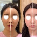 지앤씨 - 경주시 동해안로 2229 | 강남윤곽관리 신사비대칭관리 | 지앤씨웰니스센터
