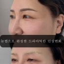 눈썹미녀 이미지