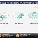 유니트론 보청기 이미지