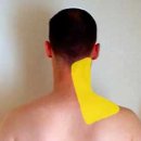 견갑거근 (LEVATOR SCAPULA) 어께의 승강기 이미지