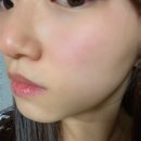 메디테스 | [보타닉힐보 프리바이오덤 크림] 피부탄력을 위한 리프팅크림 추천드려요 :)