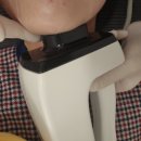 룰루멍 | 압구정역 피부과 인모드리프팅 fx 포마 후기, 멍, 다운타임 소개
