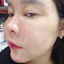 (주)델리코 | 인스타 화장품 델리케어 델리살구팩 후기 살구씨 스크럽으로 각질·피지 정리! 피부결 매끈해진 내돈내산