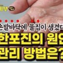 발가락 발바닥 물집 발에 물집 생겼을때 터트리기 현명한건 바로 이거죠 이미지