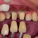 이로운치과기공소 이미지