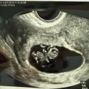 청주경희한의원 | [청계] 26년 라움 산후조리원 리뷰(자연분만 초산모의 꼼꼼한 후기)