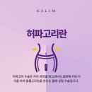 허파고리 手術 이미지