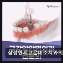 서울미소진치과의원 | [강남 임플란트 치과/추천/후기] 삼성연세고운미소치과의원 평점 4.63, 800여 건 리뷰 신뢰