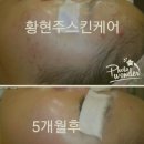 피디티 이미지