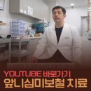 심미치과기공소 | 부산 앞니심미보철 자연스러운 앞니 복원으로