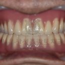 서울산성플란트치과의원 이미지