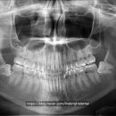 라이프치과기공소 이미지