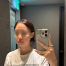 제이메디의원 | 강남역 온다리프팅 6만줄 심부볼, 팔자 뿌신 후기