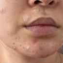 장기보령약국 이미지