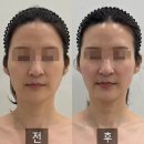 모란결혼정보 | ▶ 모란피부관리 3V윤곽테라피 에스테틱유