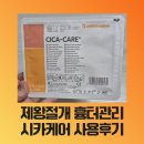 골든발란스의원 | 제왕절개 흉터관리 시카케어밴드 사용후기 (f.직구가격,효과, 사용법, 켈로이드흉터관리법)