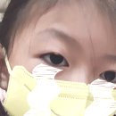 참빛안과의원 이미지