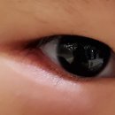 서초준안과의원 이미지