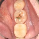 애플치과기공소 이미지